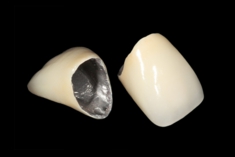 メタルボンド（陶材焼付鋳造冠）