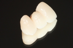 ハイブリッドセラミック